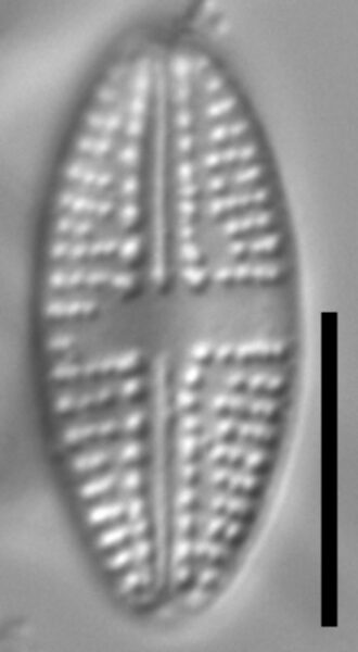 Eolimna metafarta LM2