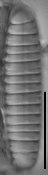 Diatoma problematica LM1