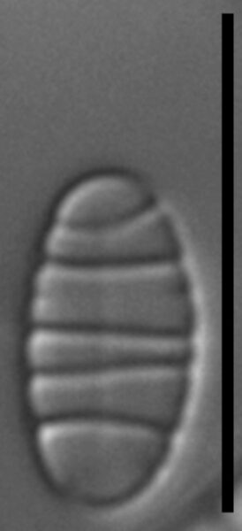 Diatoma problematica LM5