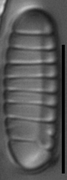Diatoma problematica LM6