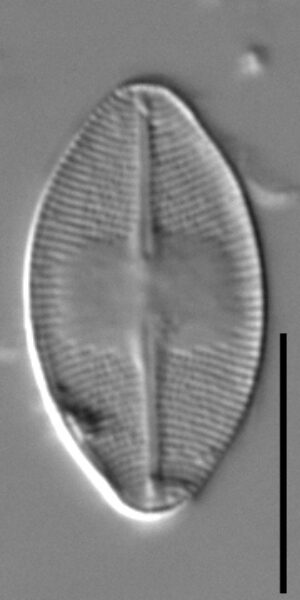 Eucocconeis americana LM1