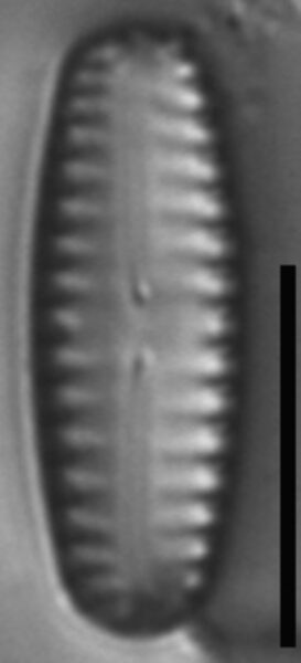 Pinnularia lagerstedtii LM5