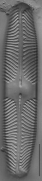 Pinnularia lacunicola LM5