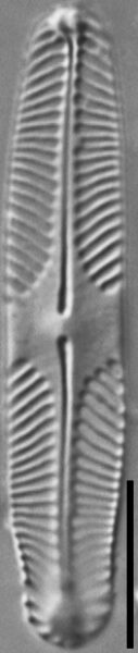 Pinnularia lacunicola LM6