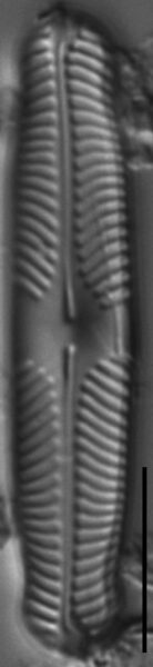 Pinnularia perinterrupta LM6