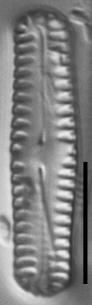 Pinnularia pseudoparva LM7