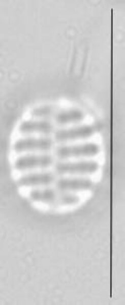 Pseudostaurosira trainorii LM4