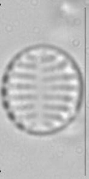 Pseudostaurosira trainorii LM1