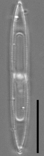 Tursiocola varicopulifera LM4