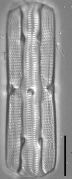Tursiocola varicopulifera LM5
