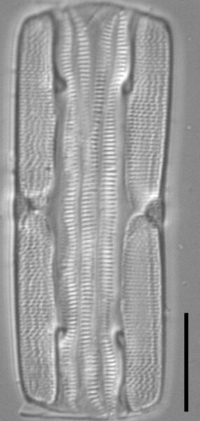 Tursiocola varicopulifera LM6