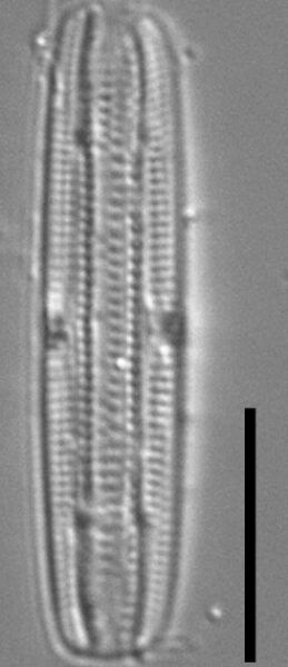 Tursiocola ziemanii LM5