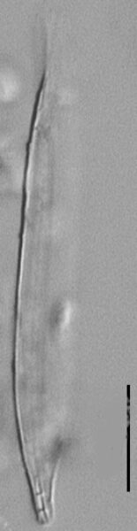 Nitzschia biacrula LM1
