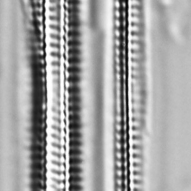 Fragilaria capucina LM5