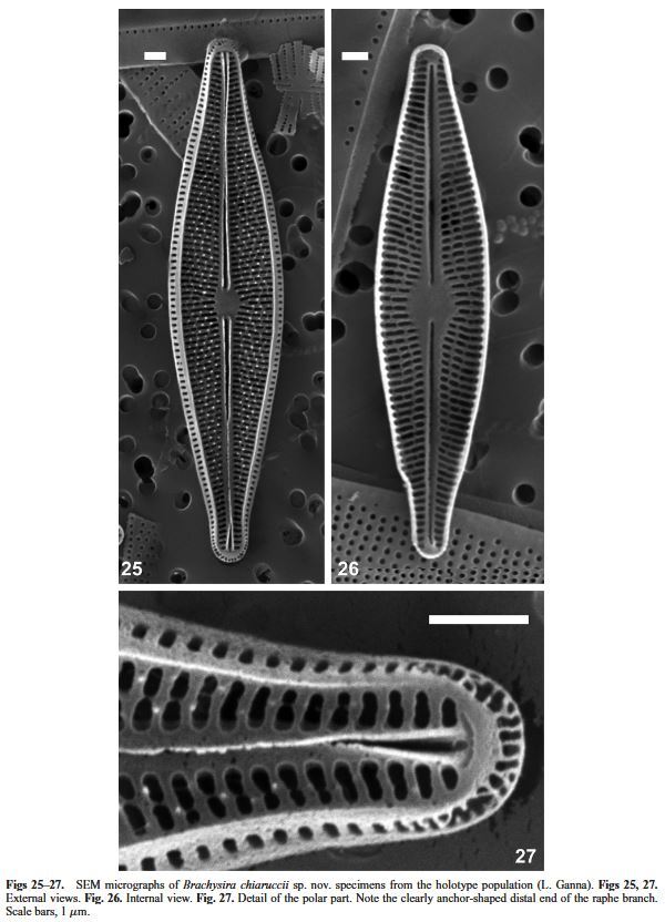 Brachysira chiaruccii Orig SEM 1