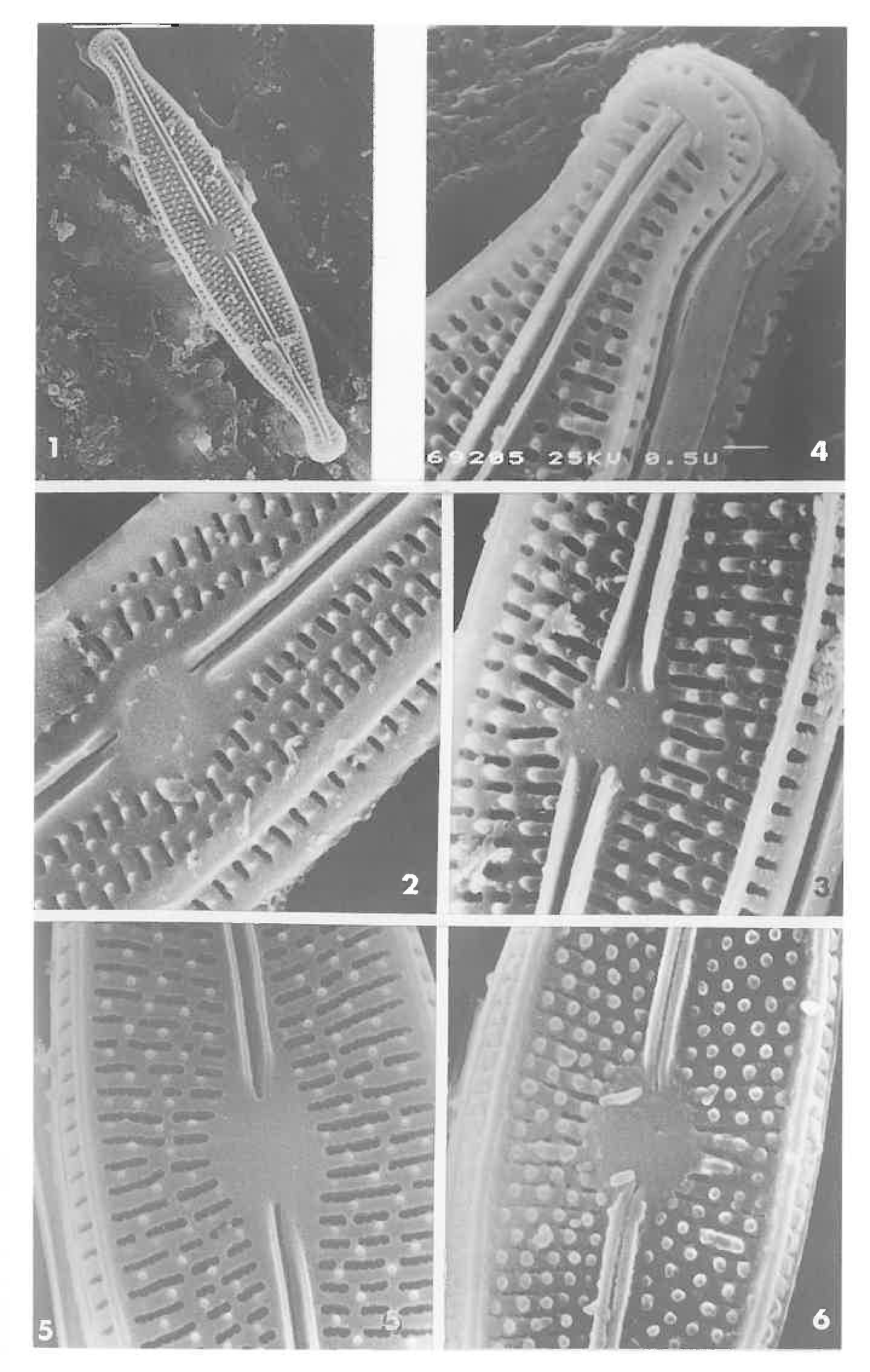 Brachysira neoexilis Orig SEM1