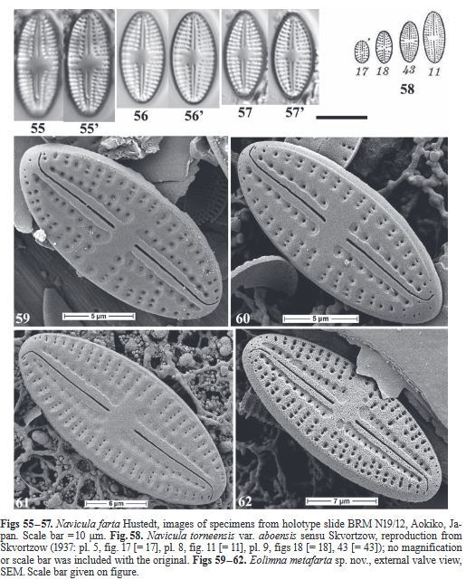 Eolimna metafarta Original SEM1