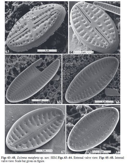 Eolimna metafarta Original SEM2