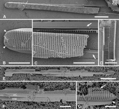 Grunowago bacillaris SEM from Lobban et al. 2022