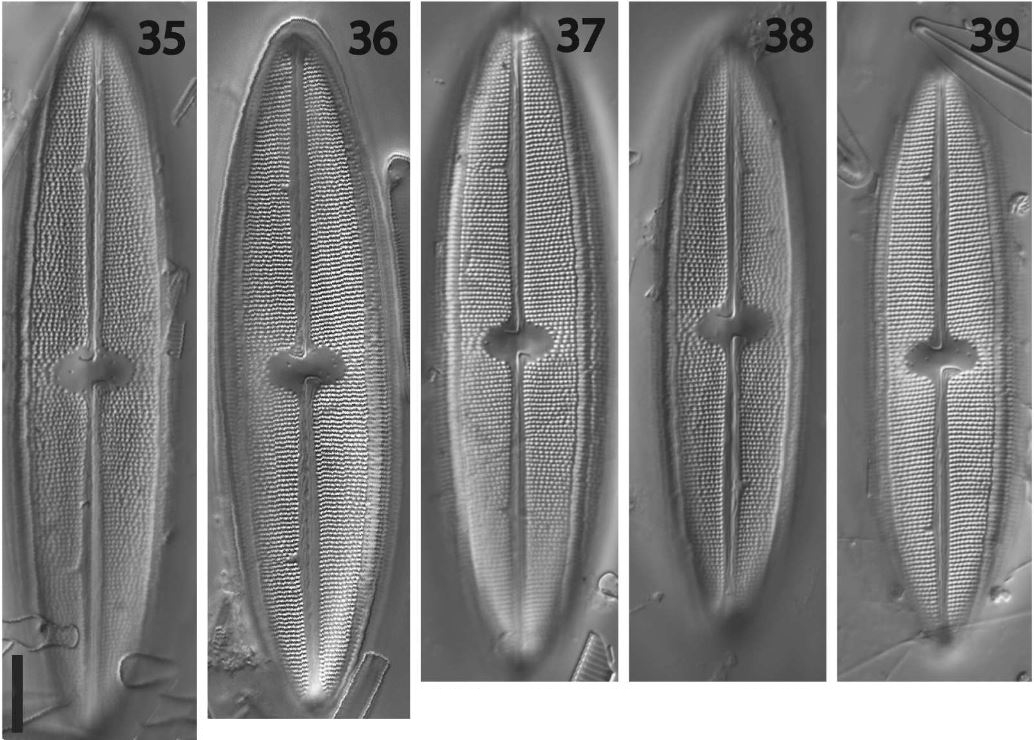 Neidium rugosum original illustration