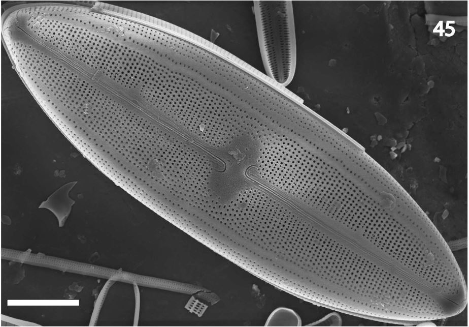 Neidium rugosum orig illus SEM1