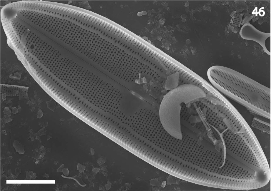 Neidium rugosum orig illus SEM2