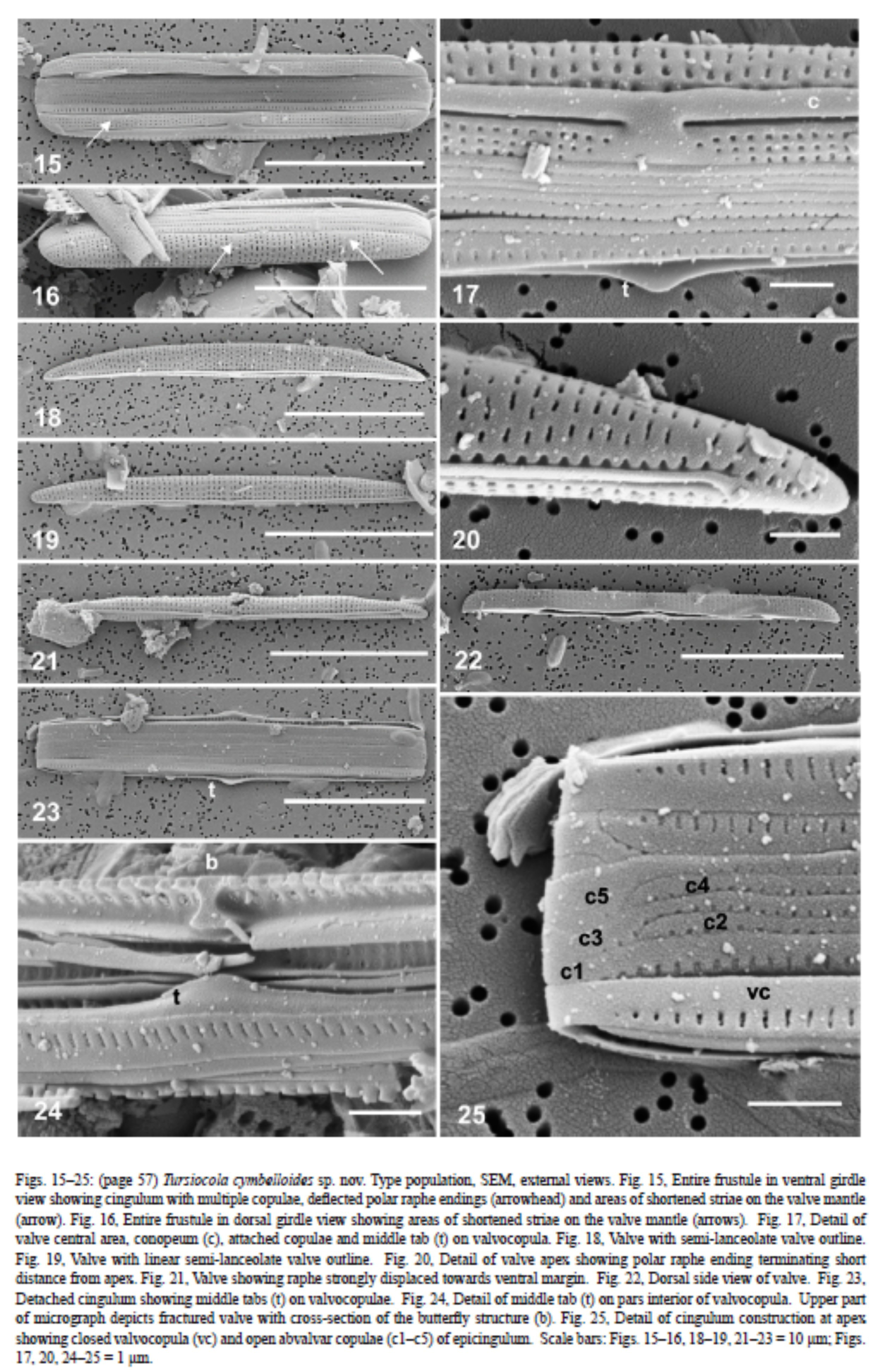 Tursiocola cymbelloides orig illus2