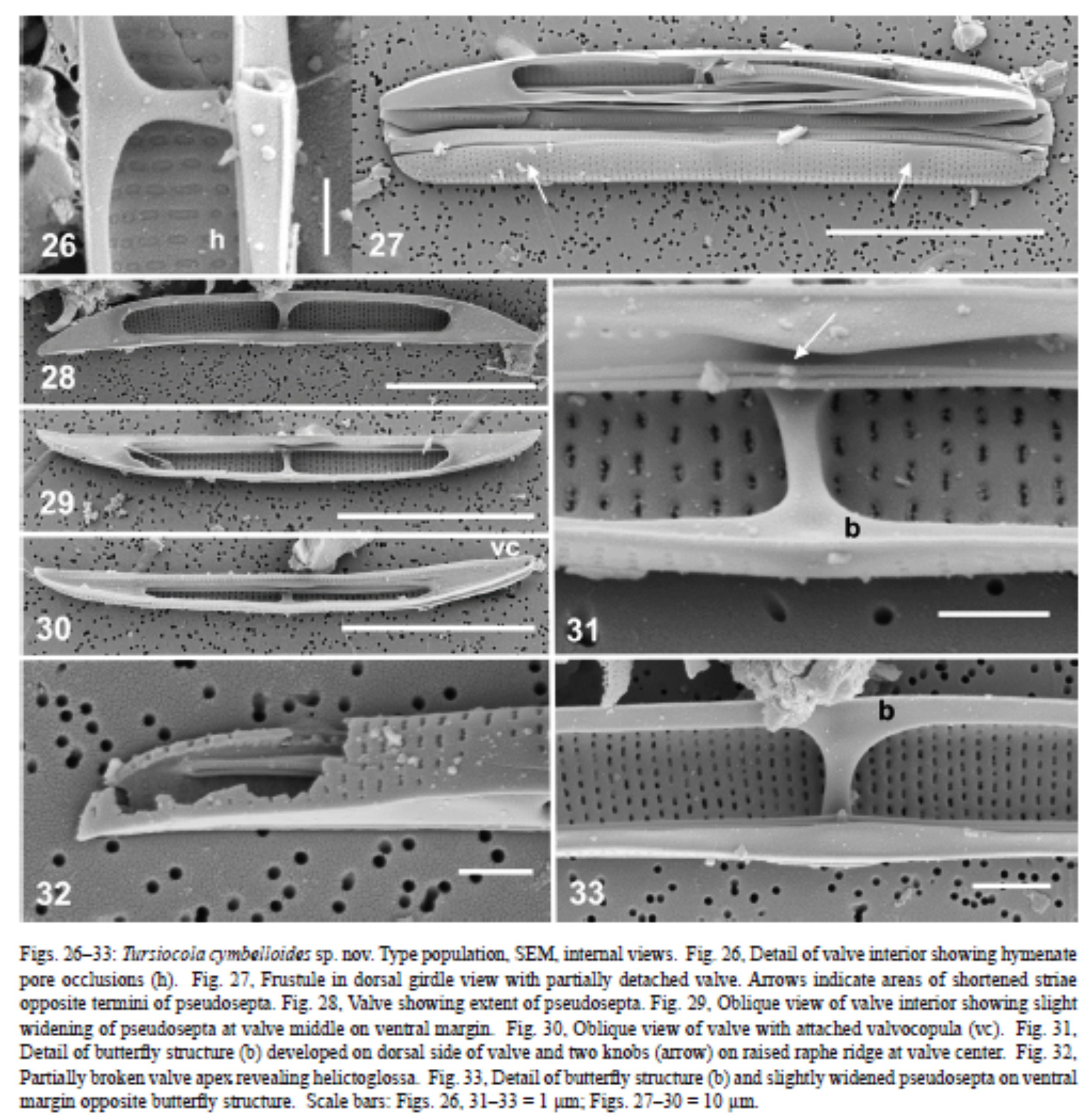 Tursiocola cymbelloides orig illus3