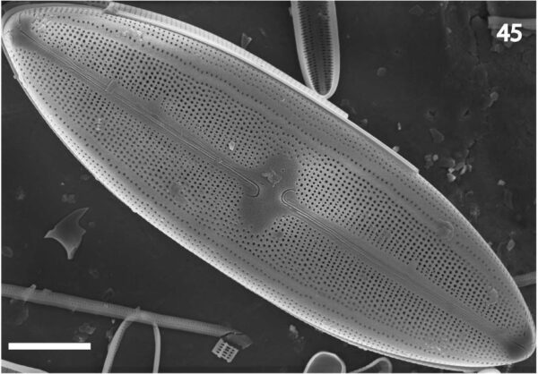 Neidium rugosum orig illus SEM1