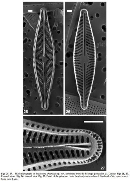 Brachysira chiaruccii Orig SEM 1