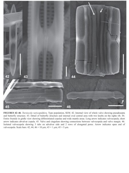 Tursiocola varicopulifera orig illus3