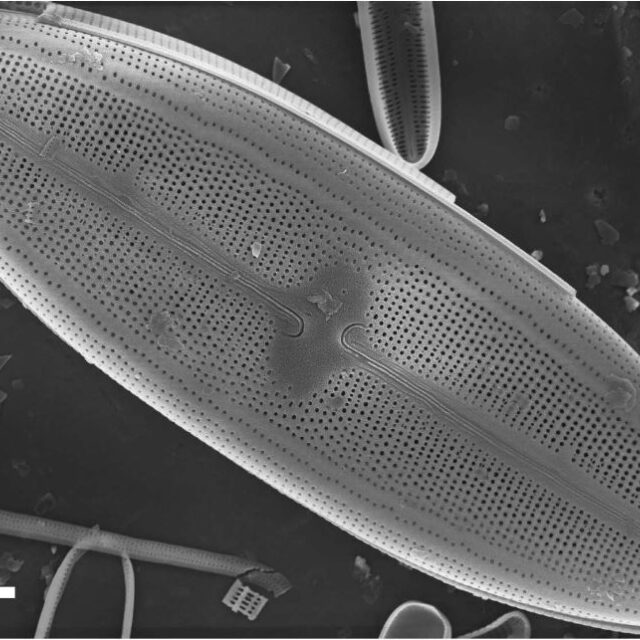 Neidium rugosum orig illus SEM1