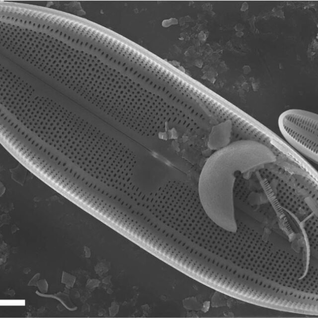 Neidium rugosum orig illus SEM2