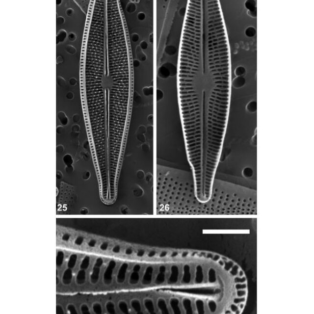 Brachysira chiaruccii Orig SEM 1