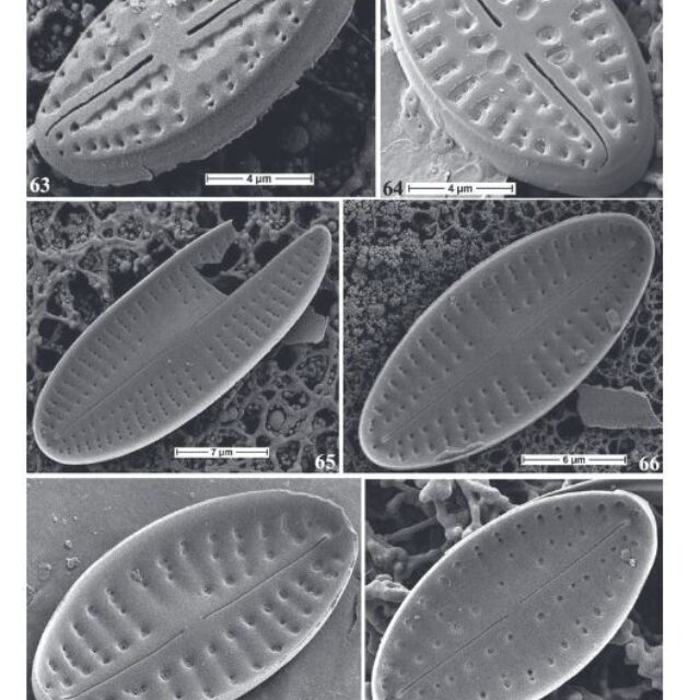 Eolimna metafarta Original SEM2