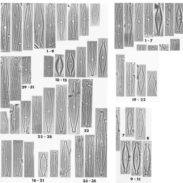 Brachysira neoexilis Orig LM