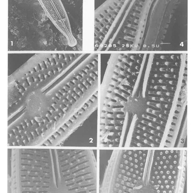 Brachysira neoexilis Orig SEM1