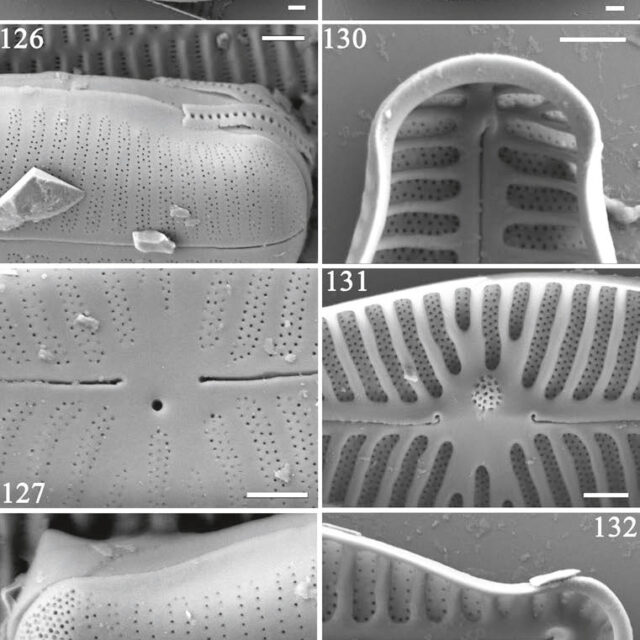 Gomphosinica Capitata  Kociolek Etal 2015 Original  Sem
