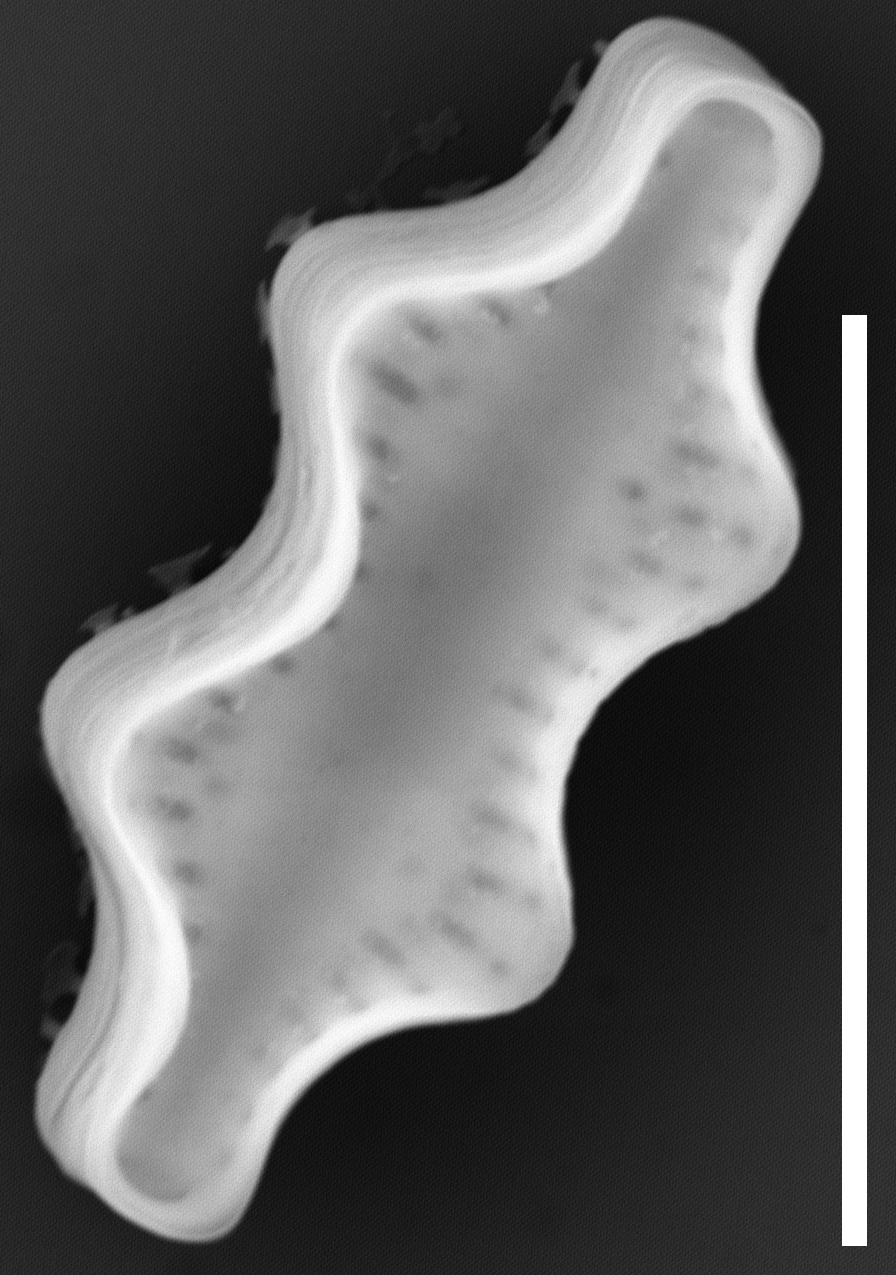 Pseudostaurosira robusta SEM2 INSTAAR 17661