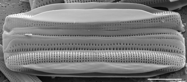 Tursiocola alata SEM1