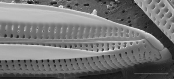 Tursiocola alata SEM3