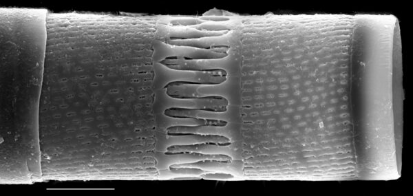 Aulacoseira italica SEM5