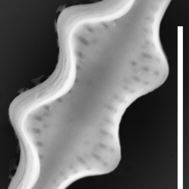 Pseudostaurosira robusta SEM2 INSTAAR 17661