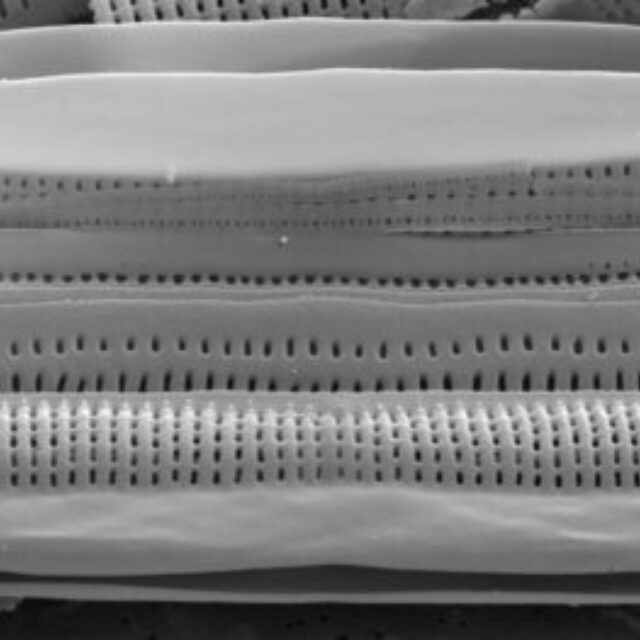 Tursiocola alata SEM1