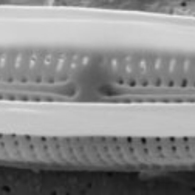 Tursiocola alata SEM2 1