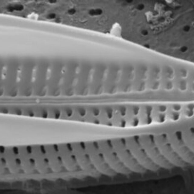 Tursiocola alata SEM3