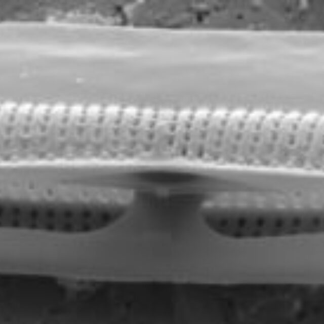 Tursiocola alata SEM4