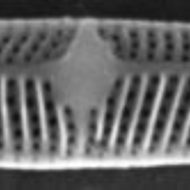 Tursiocola costata SEM3