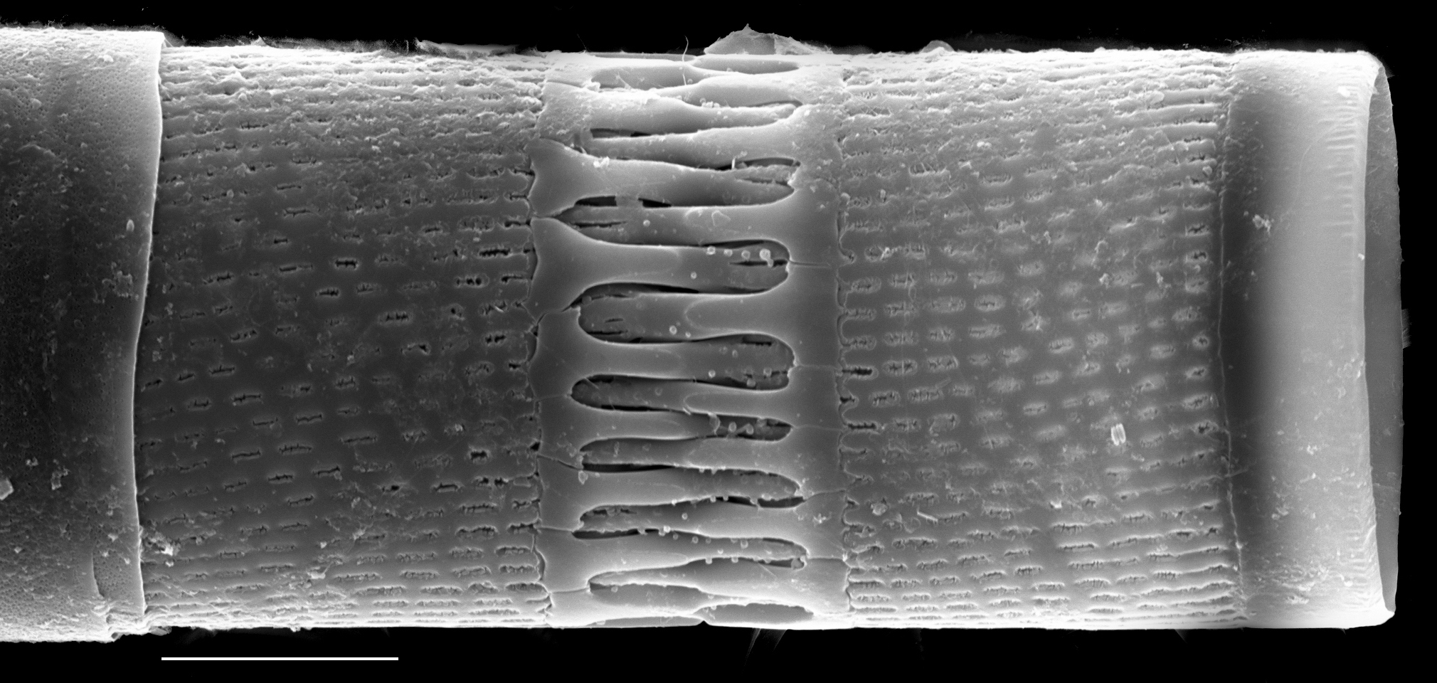 Aulacoseira italica SEM5
