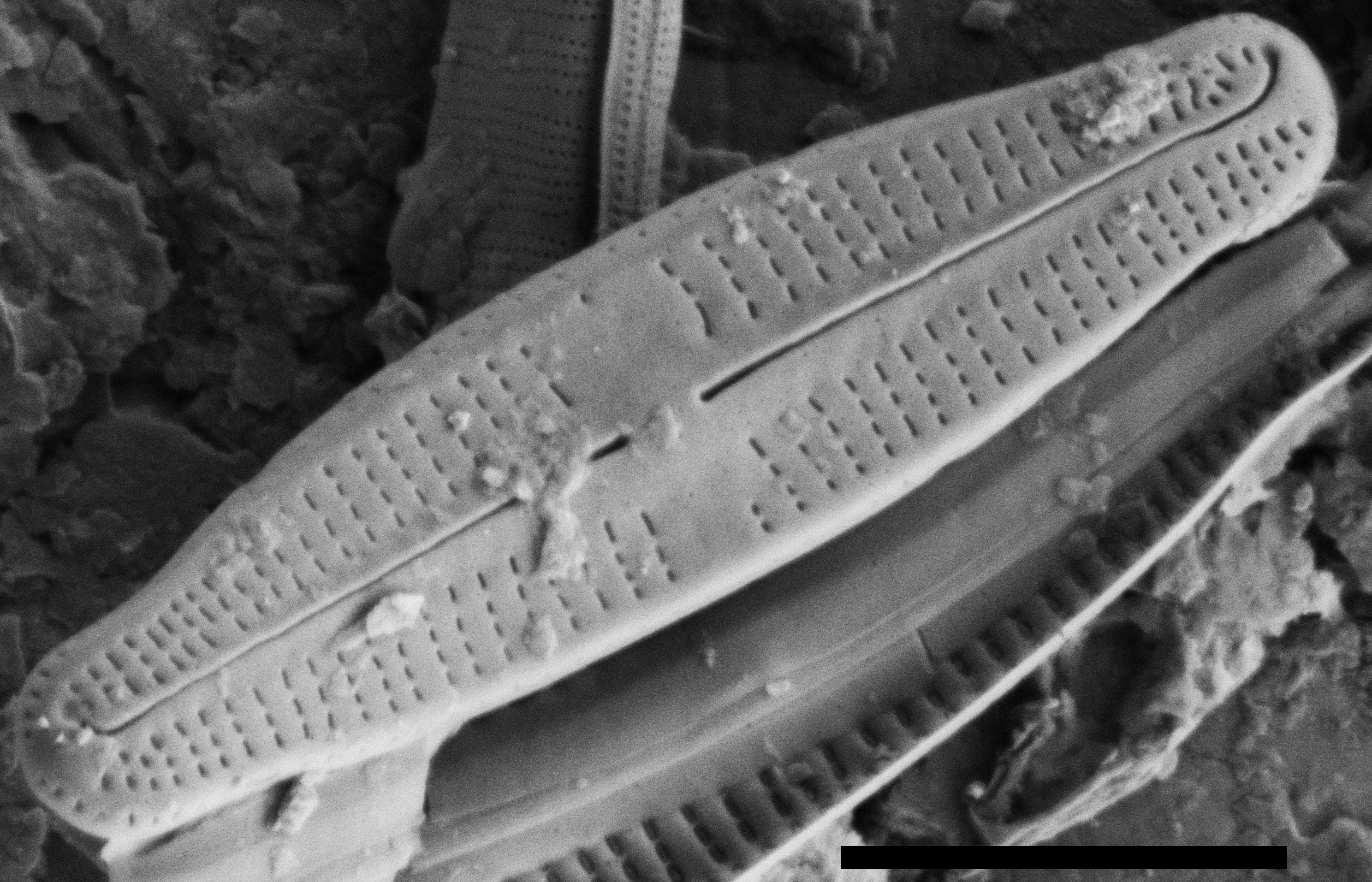 Achnanthidium thienemannii SEM2